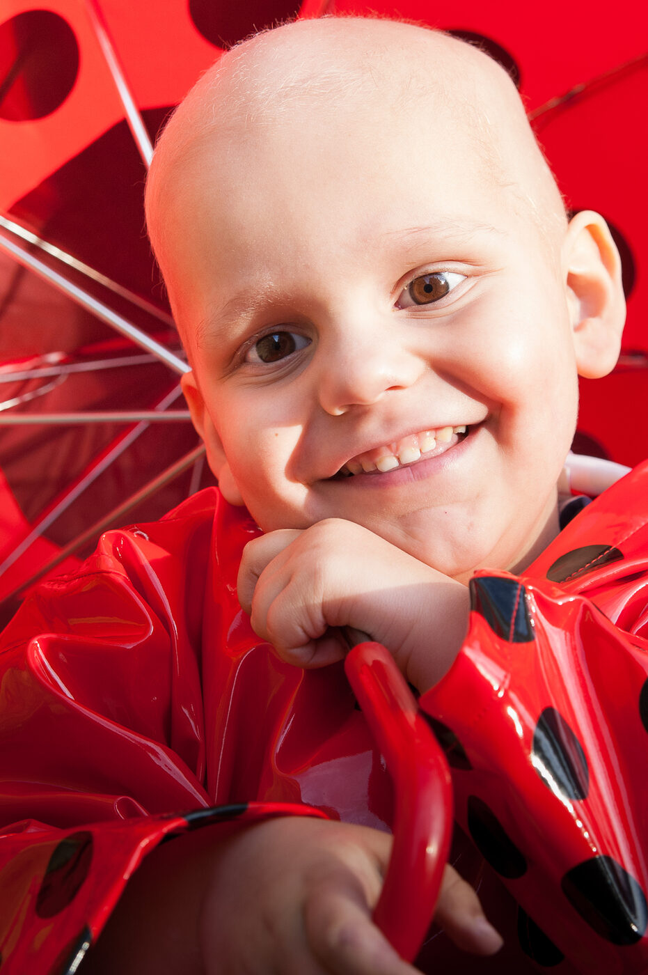 Christian, smiling under a red spotted umbrella during his treatment